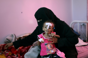 Read more about the article ‘Countdown to catastrophe’ in Yemen as U.N. warns of famine – again