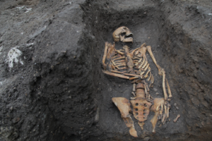 Read more about the article Medieval bones tell a stark tale of hard work and injury