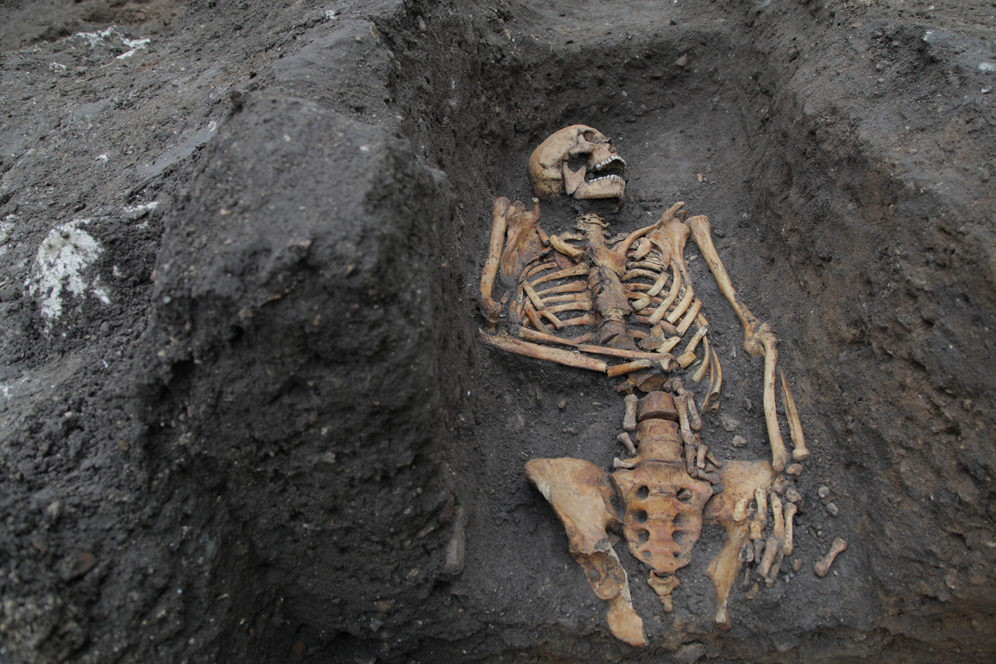 You are currently viewing Medieval bones tell a stark tale of hard work and injury