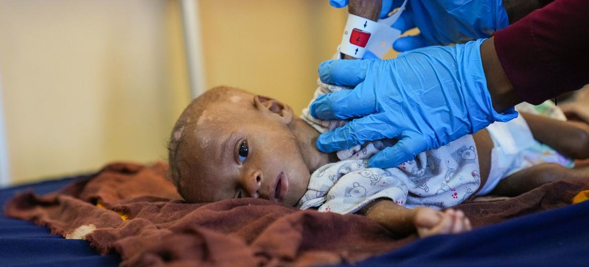 You are currently viewing Horn of Africa braces for ‘explosion of child deaths’ as hunger crisis deepens￼￼￼￼