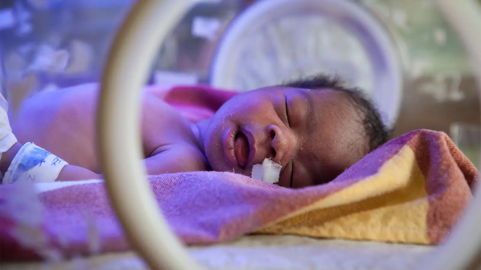 You are currently viewing Racial Disparities Seen in Preemie Lung Disease