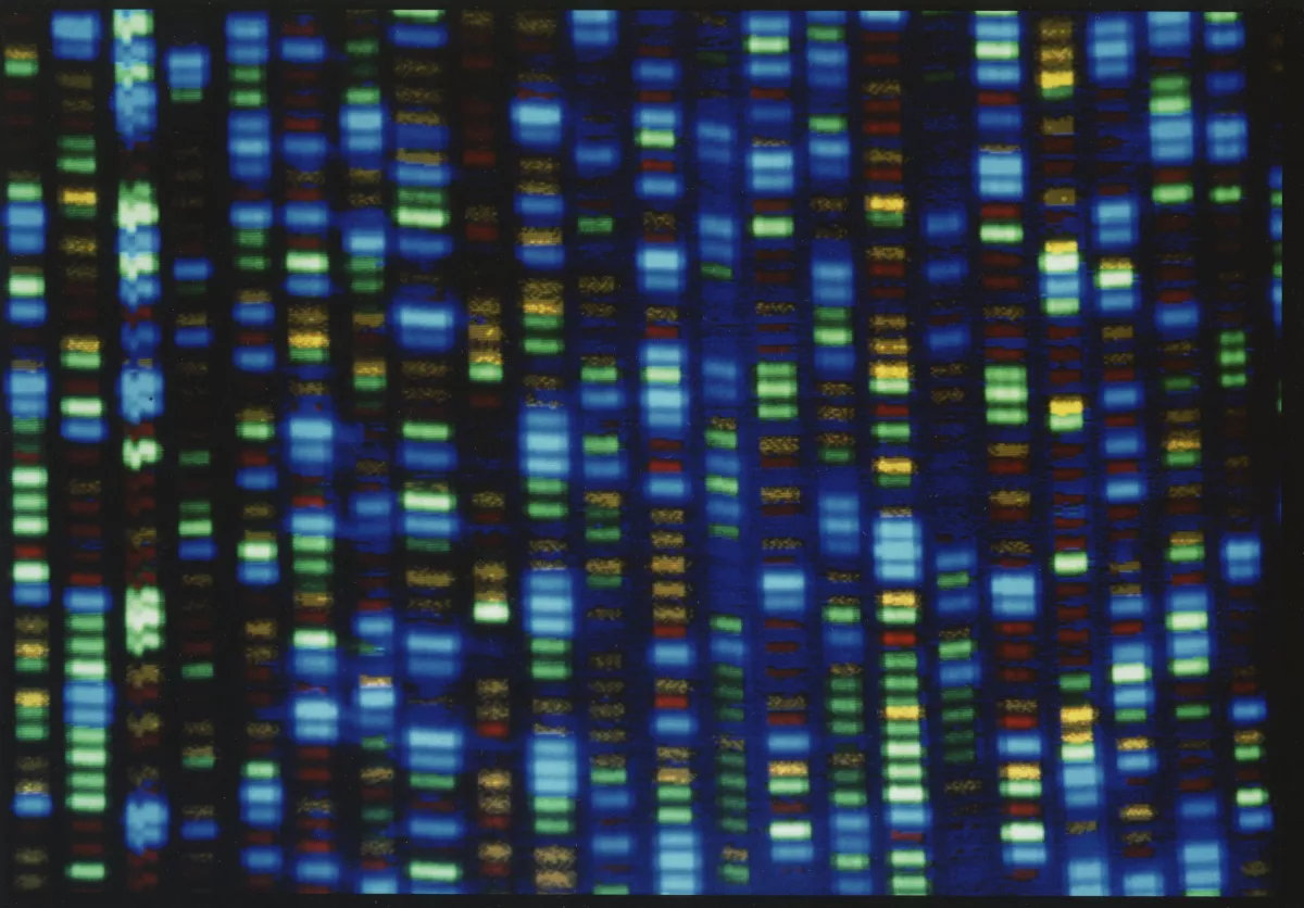 You are currently viewing Opinion: Geneticists want to close racial health disparities. But a lot of the disparities aren’t genetic