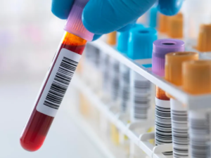 Read more about the article New blood test detects cancer seven years earlier