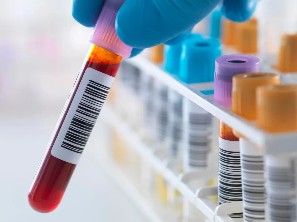 You are currently viewing New blood test detects cancer seven years earlier