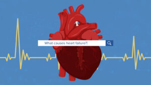 Read more about the article Cause of increase in heart failure deaths investigated