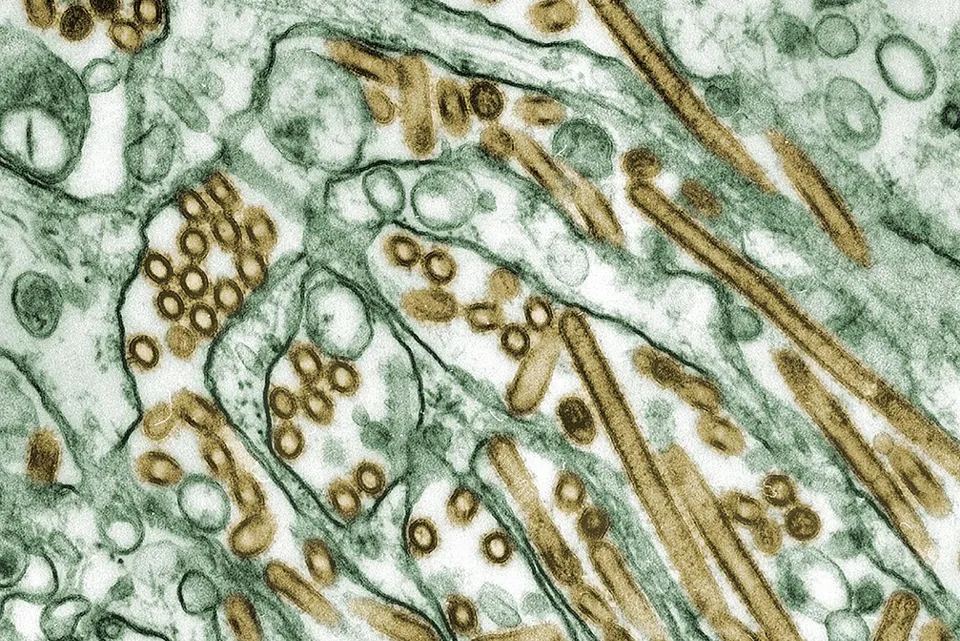 You are currently viewing Three cases of bird flu reported in America this year