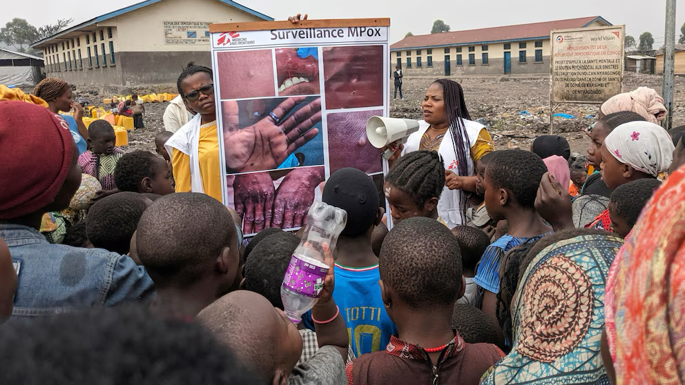 You are currently viewing WHO declares mpox outbreaks in Africa a global health emergency as a new form of the virus spreads