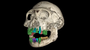 Read more about the article These Fossil Teeth From an 11-Year-Old Reveal Clues to Why Humans Developed an Unusually Long Childhood