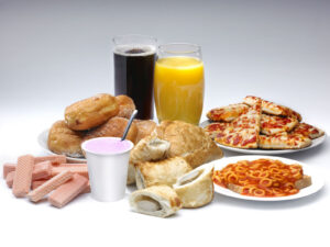 Read more about the article Colon cancer caused by inflammation and poor diet