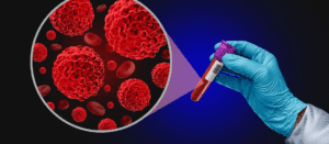 Read more about the article New blood test may help detect pancreatic cancer sooner