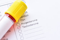 Read more about the article Low and High Testosterone Associated With PTSD Symptoms in Males and Females