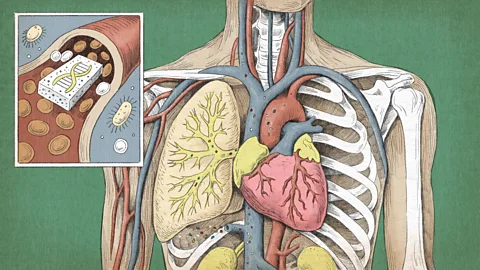 You are currently viewing Scientists find microplastics in human bones