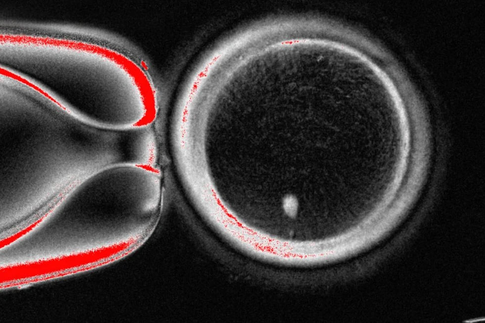 You are currently viewing Researchers turn human skin cells into eggs — but not yet usable ones