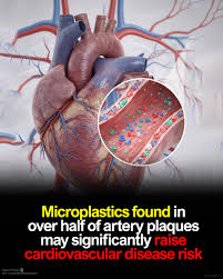 Read more about the article Microplastics may contribute to heart disease risk