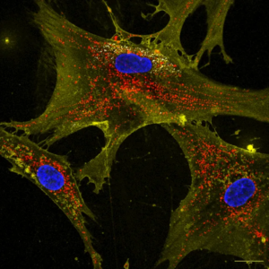 Read more about the article A New Way to Boost the Powerhouses of the Cell Might Combat Aging and Degenerative Diseases, Lab Study Suggests
