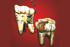 Read more about the article Ape-Like Human Ancestors Were Largely Vegetarian 3.3 Million Years Ago in South Africa, Fossil Teeth Reveal