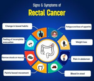 Read more about the article Common Warning Signs of Rectal Cancer