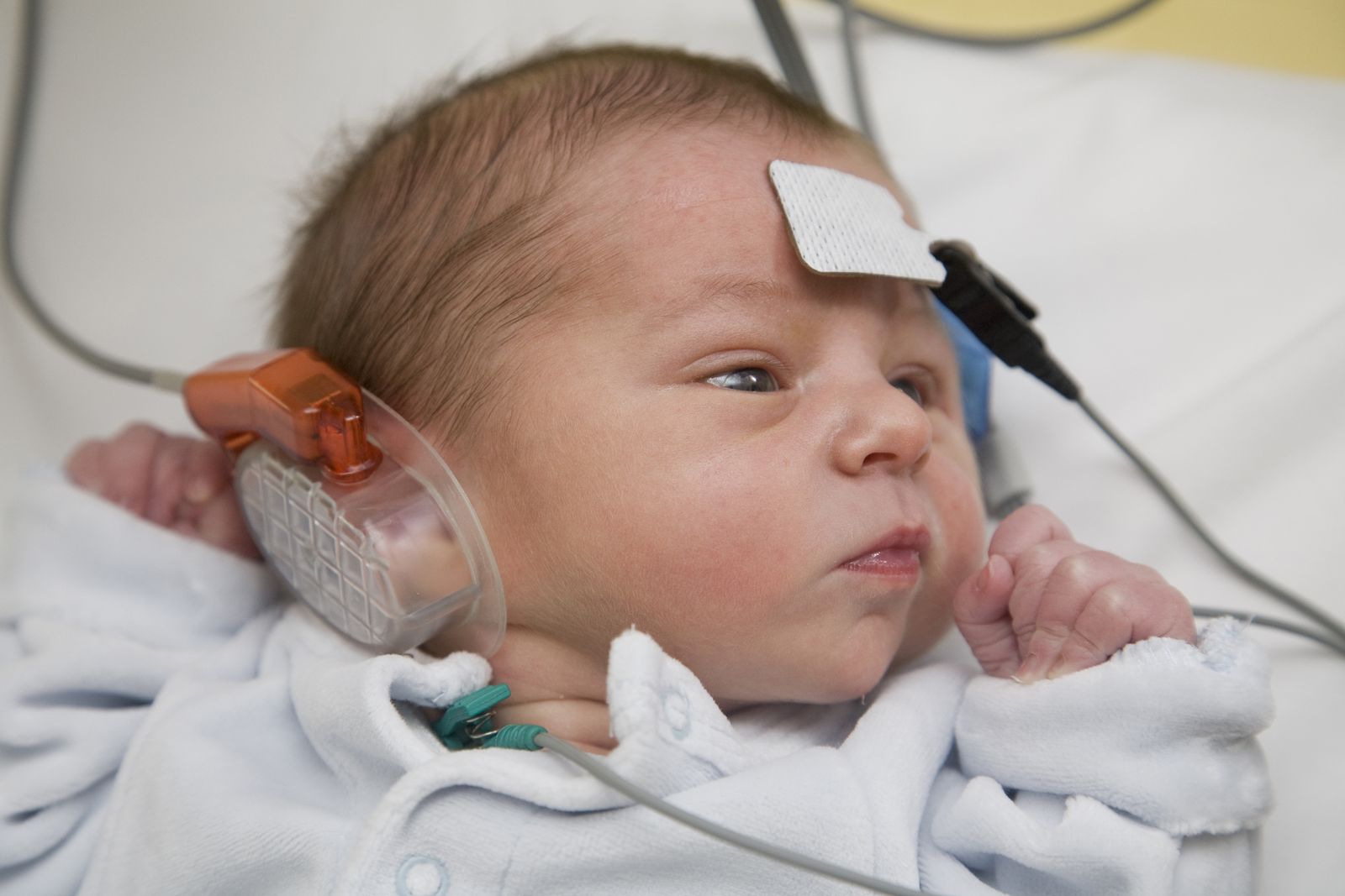 You are currently viewing FDA Approves First Gene Therapy for Deafness, Marking a New Era