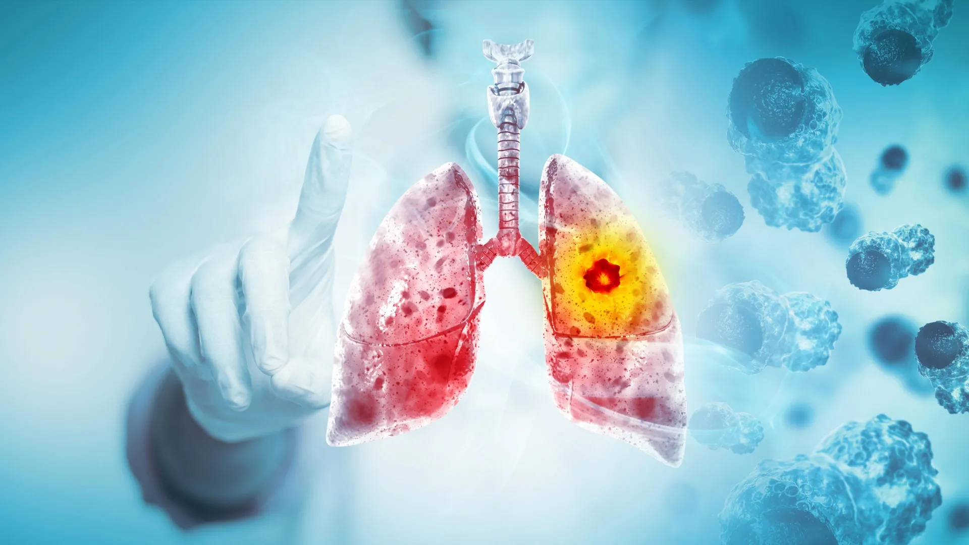 You are currently viewing A major review finds vaping likely causes lung and oral cancer