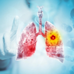 A major review finds vaping likely causes lung and oral cancer
