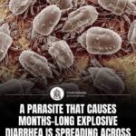 CDC says diarrhea parasite is spreading across 17 states