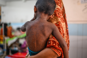 Read more about the article Bangladesh measles outbreak kills 1,000 people in six months