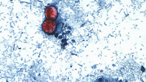 Read more about the article Cyclospora outbreak sickening thousands in 21 states is over, officials say